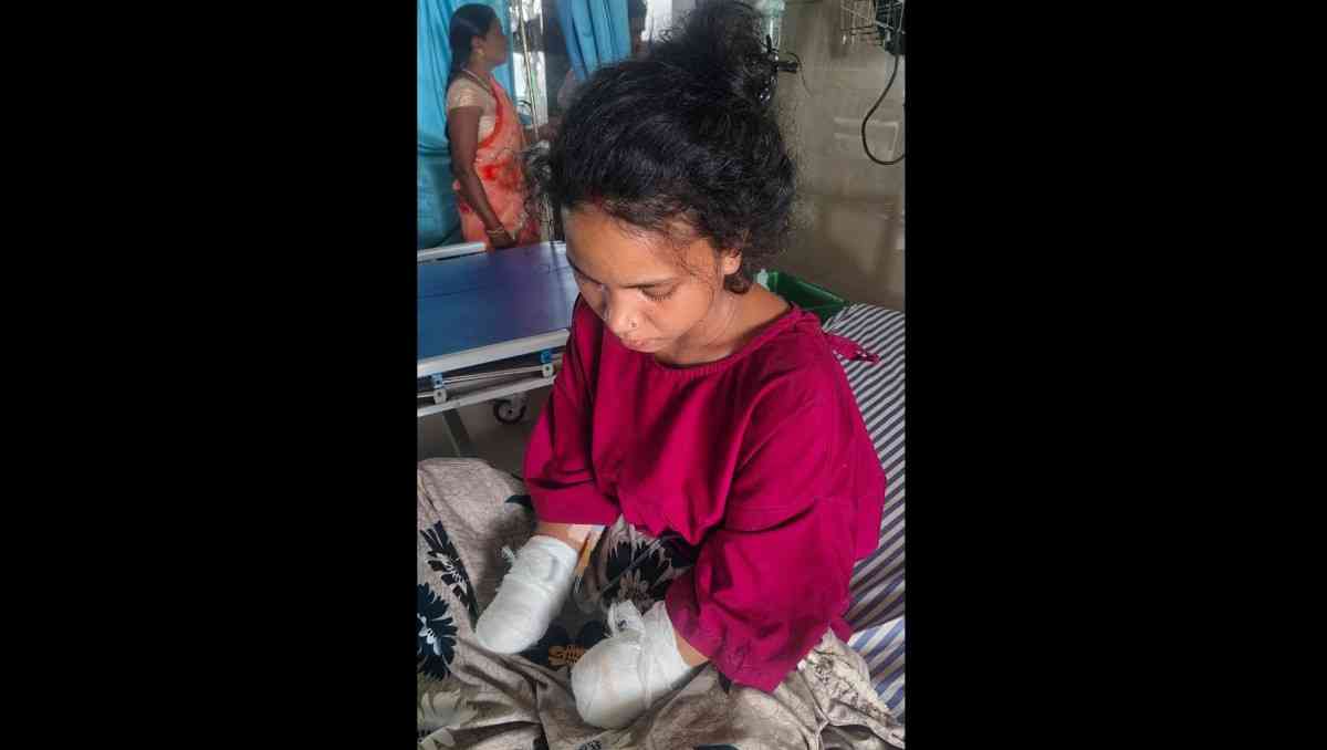वाळूज एमआयडीसीतील खासगी कंपनीत दुर्घटना, २० वर्षीय तरुणीचे दोन्ही हात निकामी