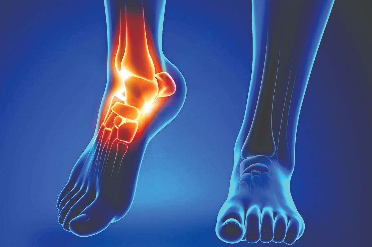 हात-पाय सुन्न होतात, नसा झाल्यात कमकुवत? डॉक्टरांनी सांगितले ३ व्हिटॅमिन, जे ठीक करतील न्यूरोपॅथी