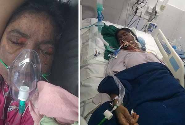 युनानी डॉक्टरने केले ॲलोपॅथी उपचार, महिलेला गोळ्यांचे रिॲक्शन, २०३ दिवसांपासून सोसतेय मरणयातना!; छत्रपती संभाजीनगरमधील धक्कादायक प्रकार