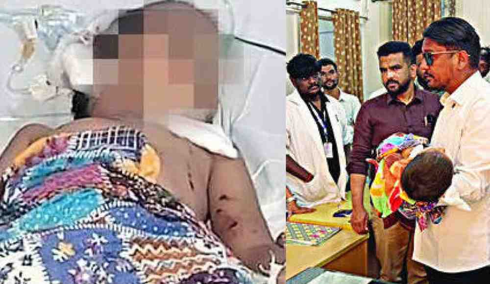 घाटीतील डॉक्टरांनी गाठला असंवेदनशीलतेचा कळस!; कुत्र्याच्या ५० चाव्यांनी चाळणी झालेल्या चिमुकलीला इंजेक्शन देऊन घरी पाठवले, MIM नगरसेवकांच्या हस्‍तक्षेपावर पुन्हा दाखल करून घेत उपचार सुरू!!